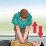 Sơ cứu người bị điện giật